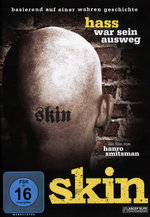Film: Skin - Hass war sein Ausweg