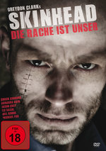 Film: Skinhead - Die Rache ist unser