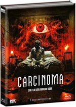 Film: Carcinoma